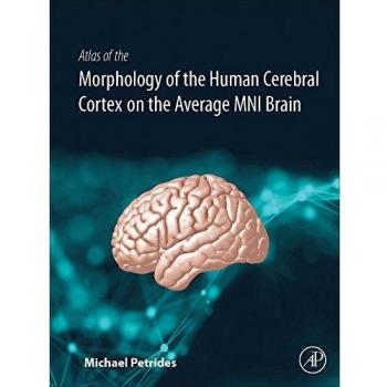 Atlas of the Morphology of the Human Cerebral Cortex on the Average MNI Brain