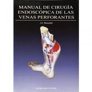 Manual de cirugía endoscópica de las venas perforantes