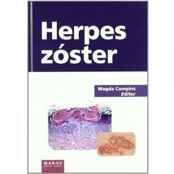 Herpes zóster