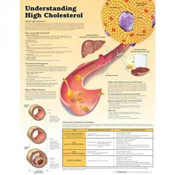 Papel de colesterol Understanding High