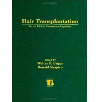 Hair Transplantation, Fourth Edition