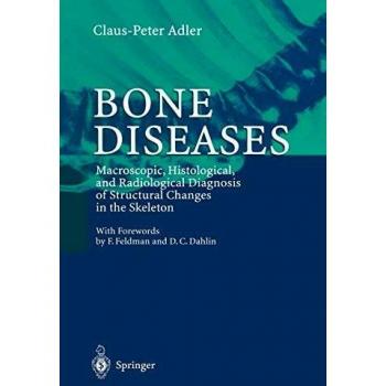 Bone Diseases: Comprehensive Macroscopic, Histological, and Radiological Diagnosis Guide