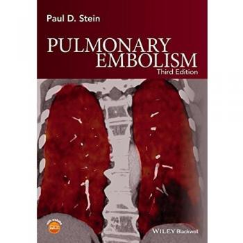 Pulmonary Embolism: Comprehensive Guide by Blackwell Publishers