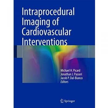 Intraprocedural Imaging of Cardiovascular Interventions