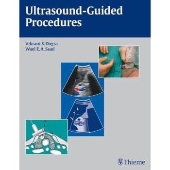 Ultrasound-Guided Medical Procedures Handbook
