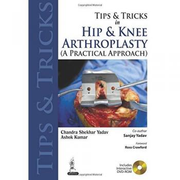 Tips and Tricks in Hip and Knee Arthroplasty: