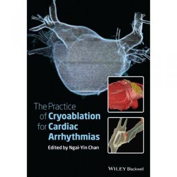 The Practice of Catheter Cryoablation for Cardiac Arrhythmias