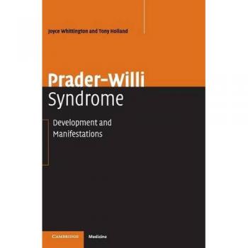 Prader-Willi Syndrome: Comprehensive Guide to Development and Manifestations by Joyce Whittington