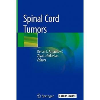 Spinal Cord Tumors