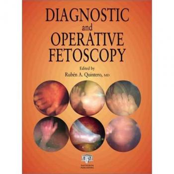 Diagnostic and Operative Fetoscopy
