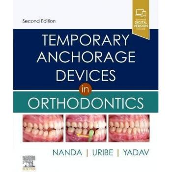Orthodontic Temporary Anchorage Devices Handbook, 2nd Edition