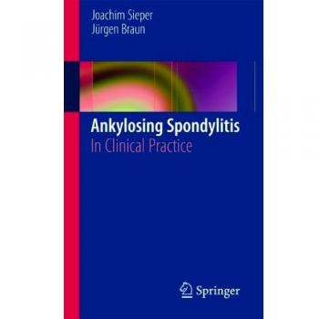 Ankylosing Spondylitis: In Clinical Practice