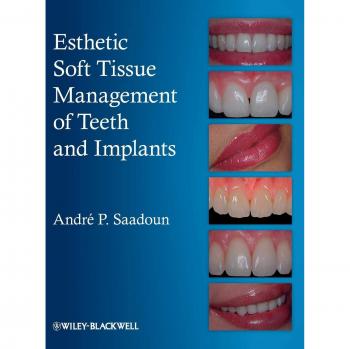 Esthetic Soft Tissue Managemen