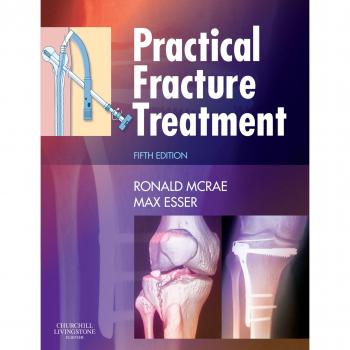 Practical Fracture Treatment, Fith Edition