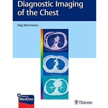 Diagnostic Imaging of the Chest