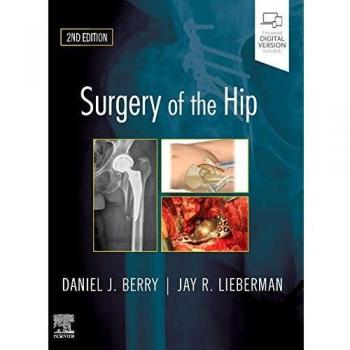 Surgery of the Hip, 2e: Expert Consult - Online and Print