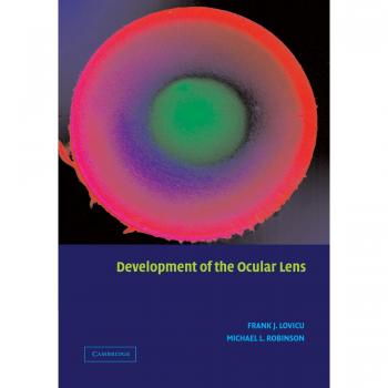 Desarrollo de la Lente Ocular - Cambridge