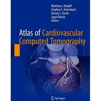 Atlas of Cardiovascular Computed Tomography