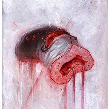Prolapse [VINYL]