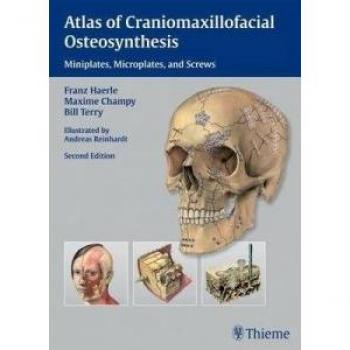 Craniomaxillofacial Osteosynthesis Atlas by Thieme Medical Publishers