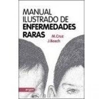 Manual ilustrado de enfermedades raras