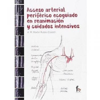 Acceso Arterial Periférico Ecoguiado En Reanimación Y Cuidados Intensivos