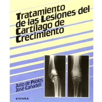Tratamiento de las lesiones del cartílago de crecimiento