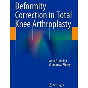 Deformity Correction in Total Knee Arthroplasty