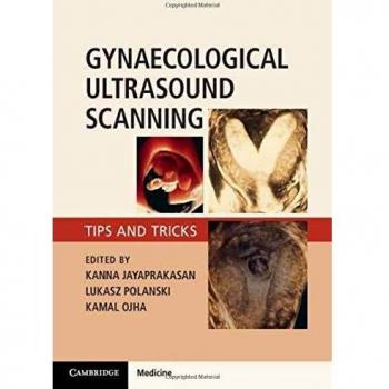 Gynaecological Ultrasound Scanning: Tips and Tricks