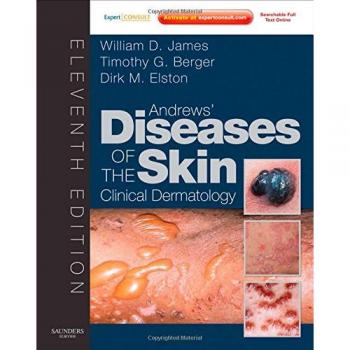 Andrews' Diseases of the Skin: Clinical Dermatology - Expert Consult - Online and Print, 11e