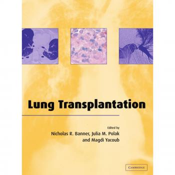 Transplante de Pulmón - Guía Completa y Avances en Cambridge