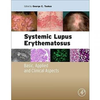 Systemic Lupus Erythematosus: Basic, Applied and Clinical Aspects