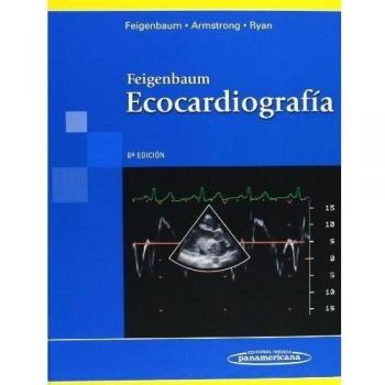 Ecocardiografía.