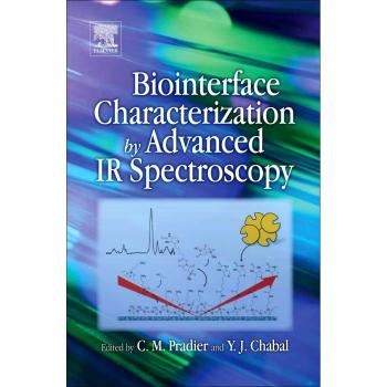 Biointerface Characterization by Advanced IR Spectroscopy