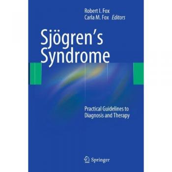 Sjögren's Syndrome: Comprehensive Diagnosis and Treatment Guide
