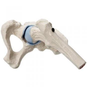 3B Scientific A84 Mini articulación de la Cadera, sin Base
