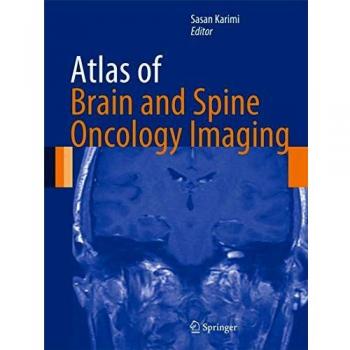 Atlas of Brain and Spine Oncology Imaging