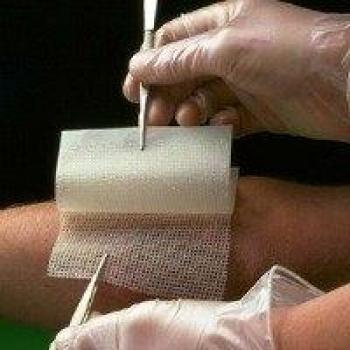 Garza Medicada Bactigras con Clorexidina Acetato 0,5% 10x10 cm - Paquete de 10 unidades