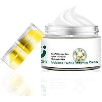 ZeLight Crema Blanqueadora Facial para Mujer,Anti-Envejecimiento Hidratante Crema de Anti Manchas Cara con Ácido Hialurónico,Eliminación de pecas,Puntos Oscuros,Tratamiento para el Cuidado de la Piel