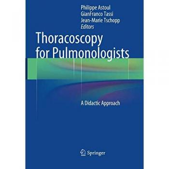 Thoracoscopy for Pulmonologists: A Didactic Approach