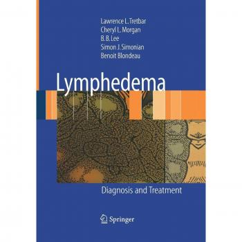 Lymphedema: Diagnosis and Treatment