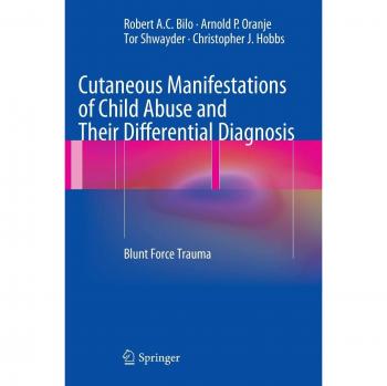 Hardback Guide on Cutaneous Manifestations of Child Abuse and Blunt Force Trauma Diagnosis
