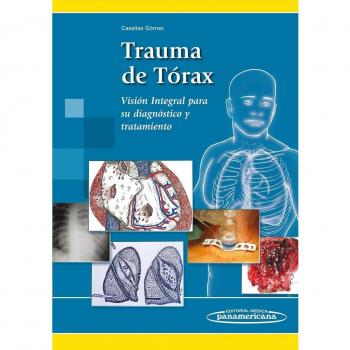 Trauma de torax: Visión integral para su diagnóstico y tratamiento