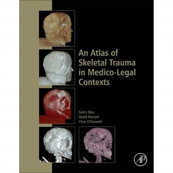 An Atlas of Skeletal Trauma in Medico-Legal Contexts
