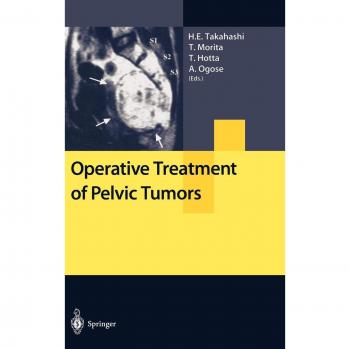 Pelvic Tumor Surgical Management Guide