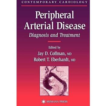 Peripheral Arterial Disease: Diagnosis and Treatment