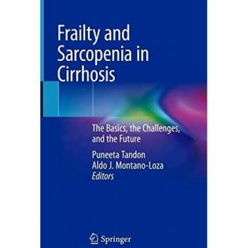 Frailty and Sarcopenia in Cirrhosis: A Personalized Approach
