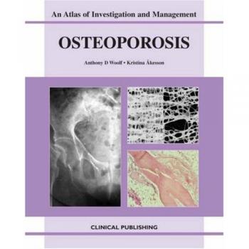 Osteoporosis