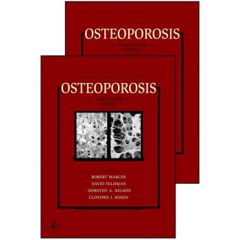 Osteoporosis