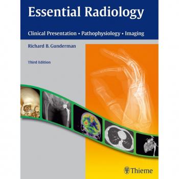 Essential Radiology: Clinical Presentation, Pathophysiology, and Imaging (3rd Edition)